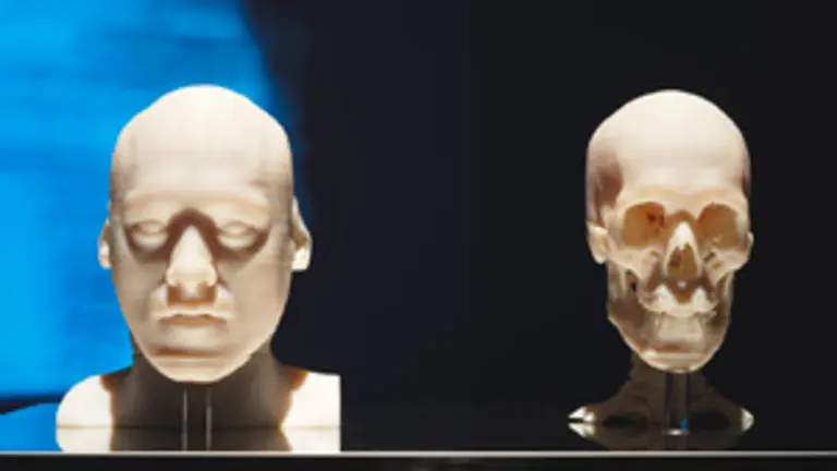  La obra &lsquo;TACs&rsquo;, de &Iacute;&ntilde;igo Bilbao, ser&aacute; una de las obras expuestas en Austria.